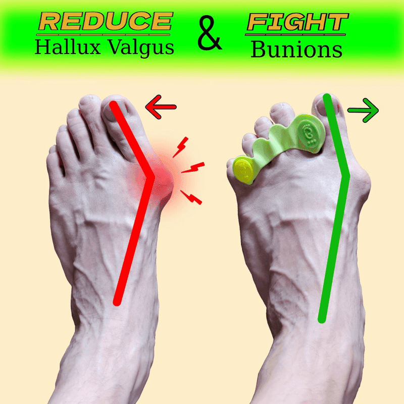 Toe Spreaders by Allways barefoot - Combat Bunions & Strengthen Arches - View 3